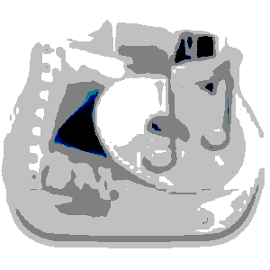 地铁笨蛋4